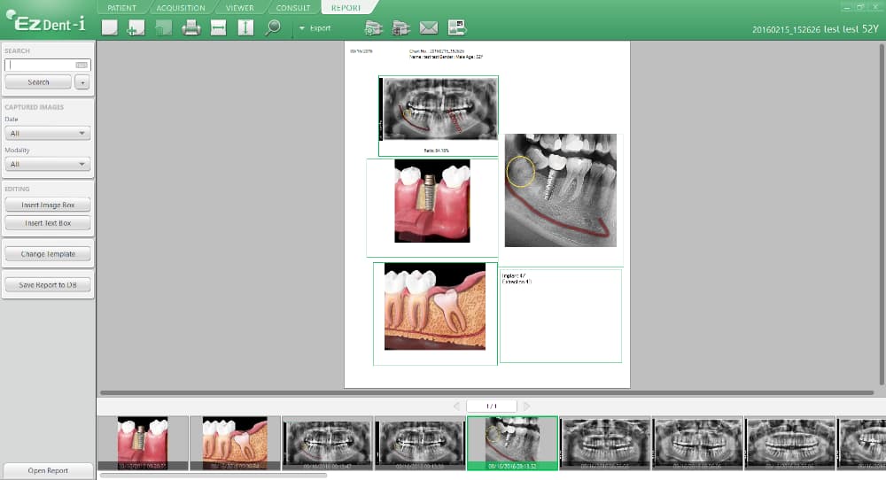 zubní software - EzDent-i - 3